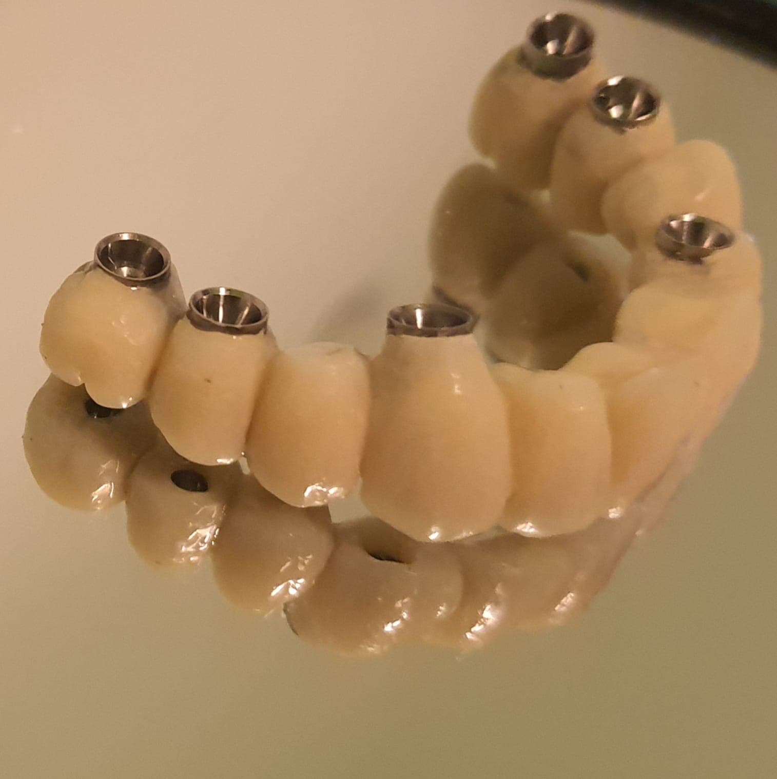 Chirurgia Implantare